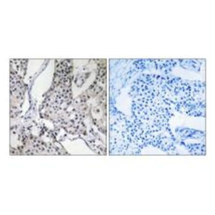 Immunohistochemistry - PHLDA3 Antibody from Signalway Antibody (34295) - Antibodies.com