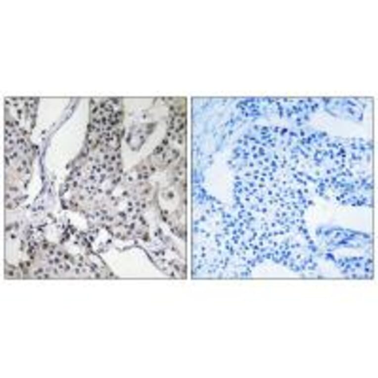 Immunohistochemistry - PHLDA3 Antibody from Signalway Antibody (34295) - Antibodies.com