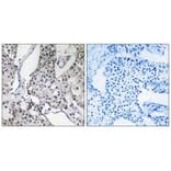 Immunohistochemistry - PHLDA3 Antibody from Signalway Antibody (34295) - Antibodies.com