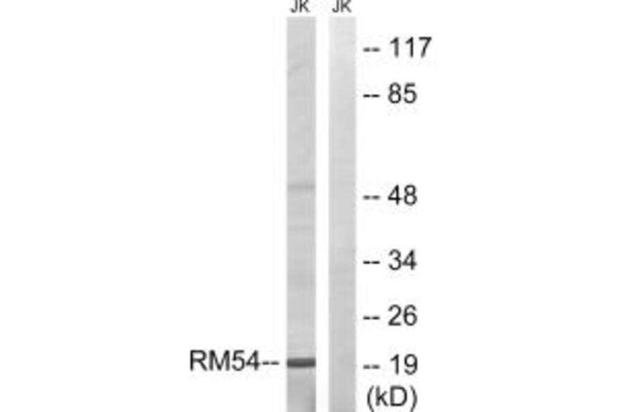 Western blot - MRPL54 Antibody from Signalway Antibody (34313) - Antibodies.com