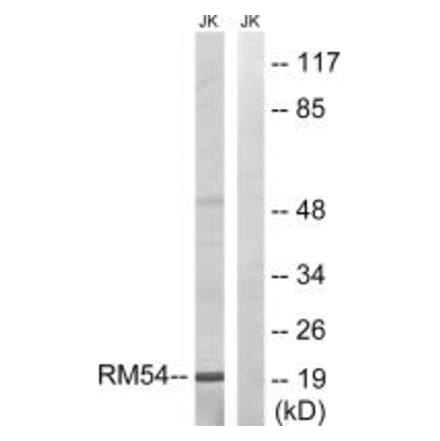 Western blot - MRPL54 Antibody from Signalway Antibody (34313) - Antibodies.com