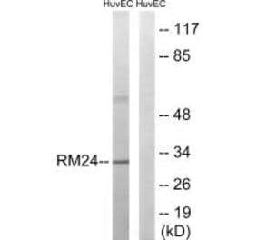 Western blot - MRPL24 Antibody from Signalway Antibody (34323) - Antibodies.com