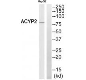 Western blot - ABCB7 Antibody from Signalway Antibody (34460) - Antibodies.com