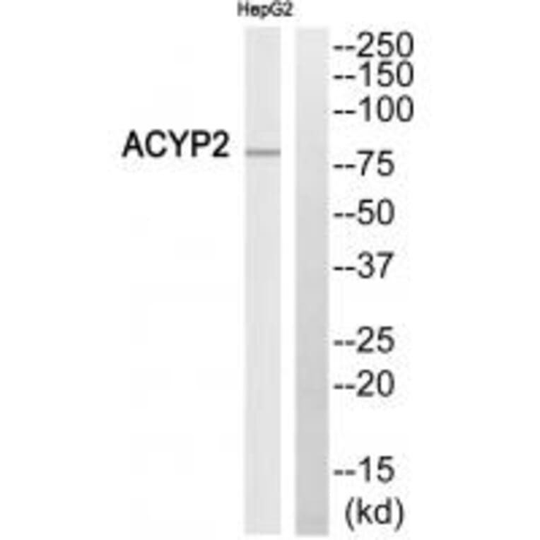 Western blot - ABCB7 Antibody from Signalway Antibody (34460) - Antibodies.com