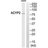 Western blot - ABCB7 Antibody from Signalway Antibody (34460) - Antibodies.com