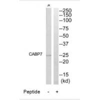 Western blot analysis of extracts from Jurkat cells, using CABP7 antibody #34516.