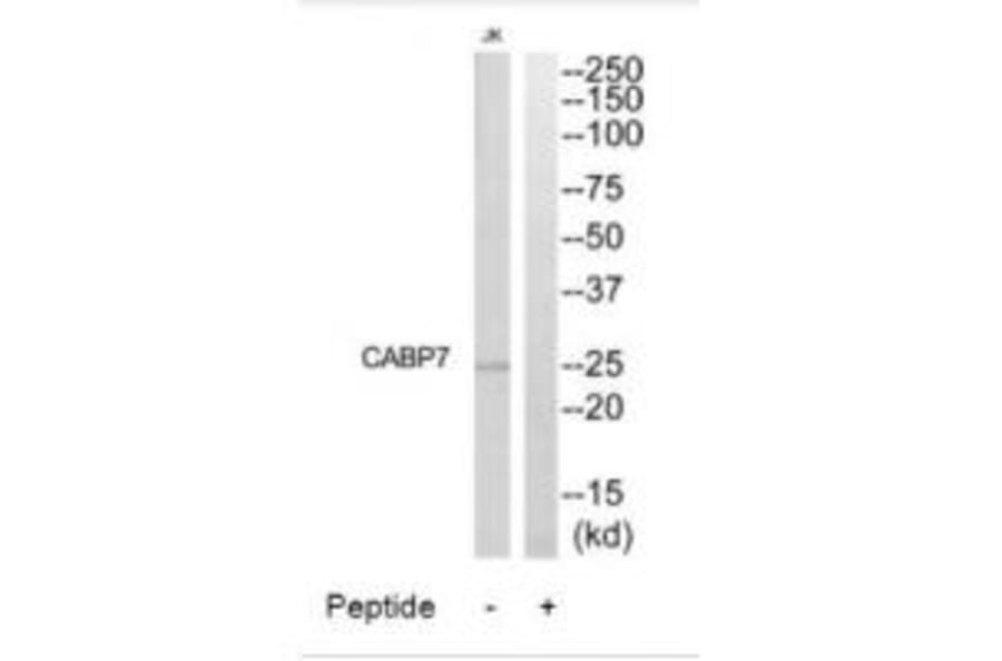 Western blot - CABP7 Antibody from Signalway Antibody (34516) - Antibodies.com