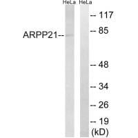 Western blot analysis of extracts from HeLa cells, using ARPP21 antibody #34524.
