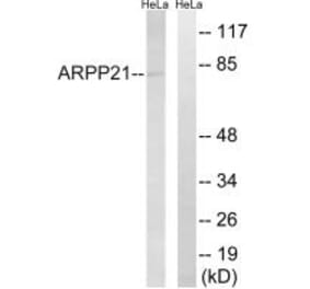 Western blot - ARPP21 Antibody from Signalway Antibody (34524) - Antibodies.com