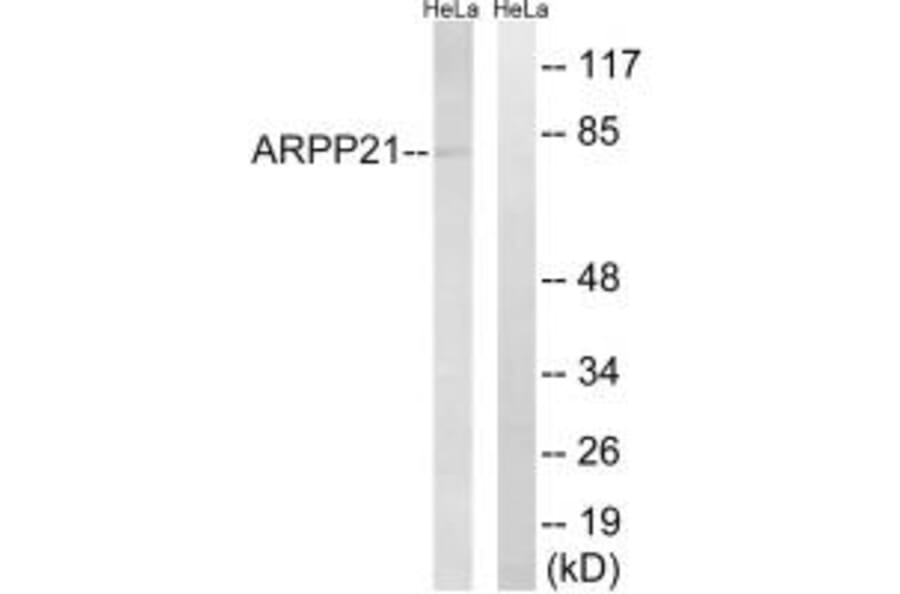 Western blot - ARPP21 Antibody from Signalway Antibody (34524) - Antibodies.com