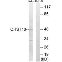 Western blot analysis of extracts from HuvEc cells, using CHST10 antibody #34532.