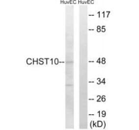 Western blot - CHST10 Antibody from Signalway Antibody (34532) - Antibodies.com