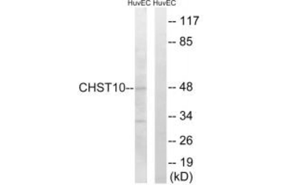 Western blot - CHST10 Antibody from Signalway Antibody (34532) - Antibodies.com