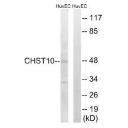 Western blot - CHST10 Antibody from Signalway Antibody (34532) - Antibodies.com