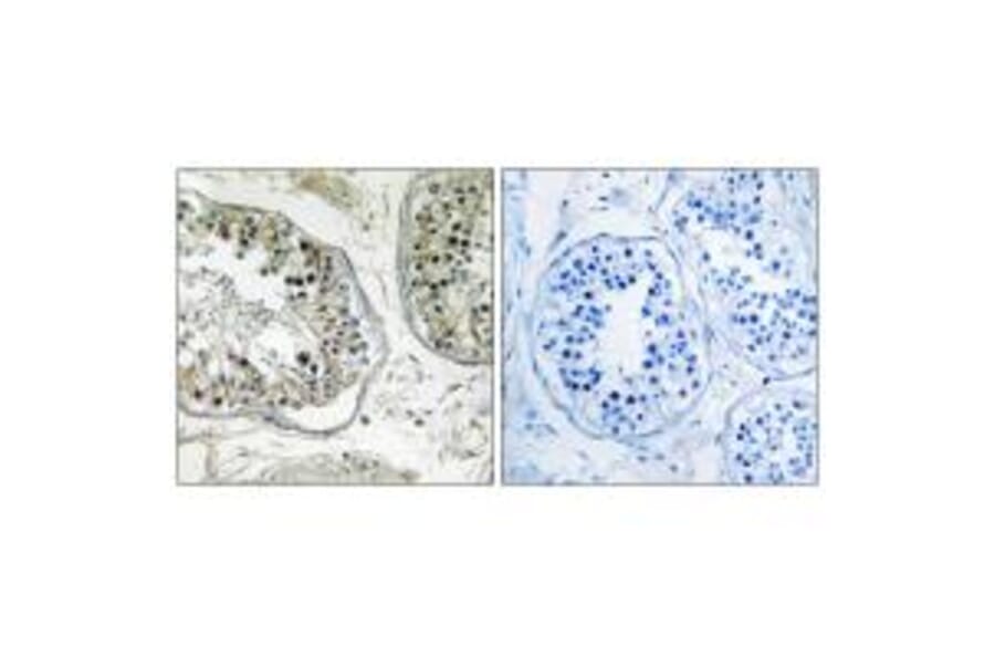 Immunohistochemistry - CHST13 Antibody from Signalway Antibody (34533) - Antibodies.com