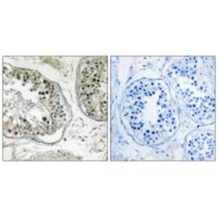 Immunohistochemistry - CHST13 Antibody from Signalway Antibody (34533) - Antibodies.com