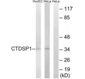 Western blot - CTDSP1 Antibody from Signalway Antibody (34552) - Antibodies.com