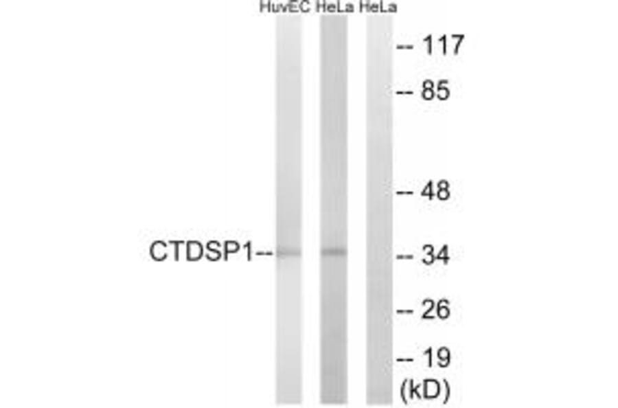 Western blot - CTDSP1 Antibody from Signalway Antibody (34552) - Antibodies.com