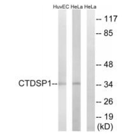 Western blot - CTDSP1 Antibody from Signalway Antibody (34552) - Antibodies.com