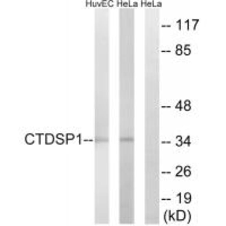 Western blot - CTDSP1 Antibody from Signalway Antibody (34552) - Antibodies.com