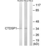 Western blot - CTDSP1 Antibody from Signalway Antibody (34552) - Antibodies.com