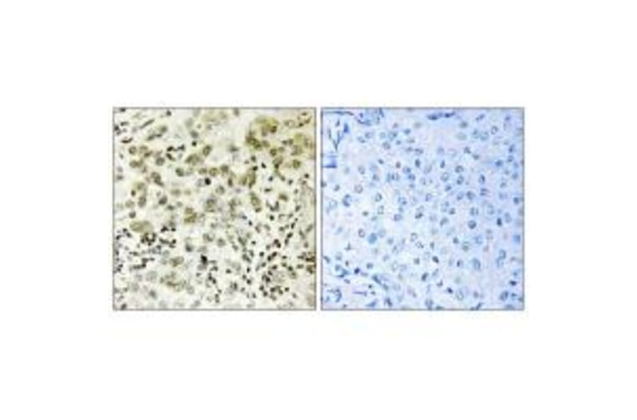 Immunohistochemistry - CTDSP1 Antibody from Signalway Antibody (34552) - Antibodies.com