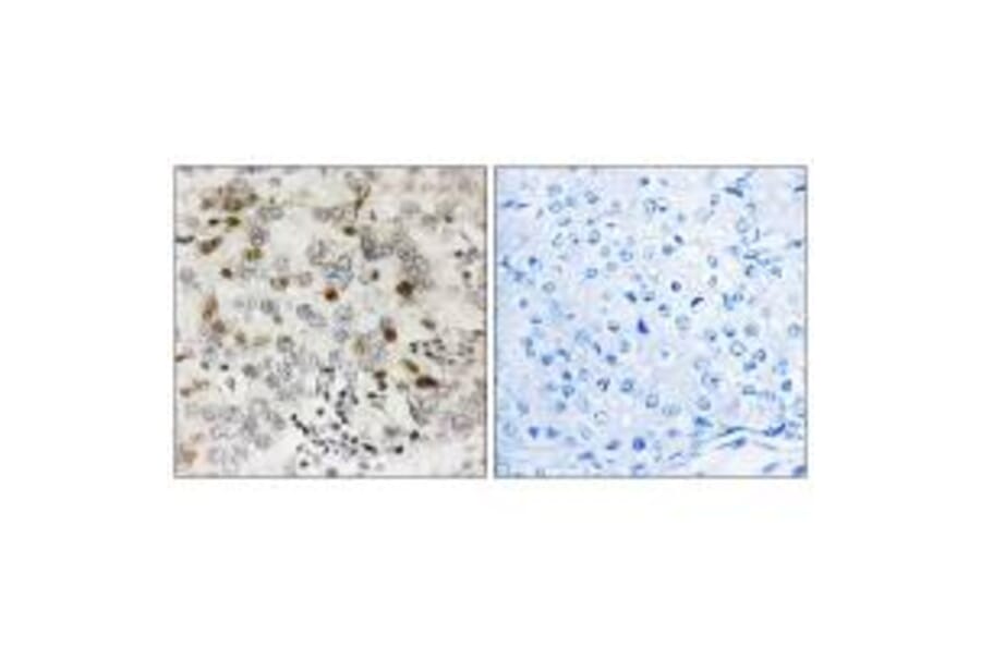 Immunohistochemistry - CGREF1 Antibody from Signalway Antibody (34560) - Antibodies.com