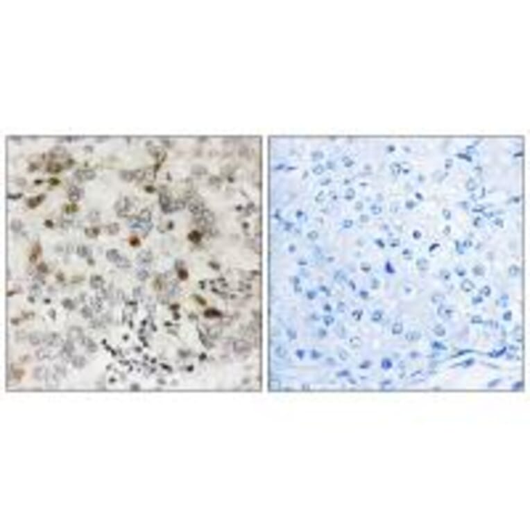 Immunohistochemistry - CGREF1 Antibody from Signalway Antibody (34560) - Antibodies.com