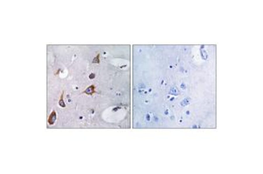 Immunohistochemistry - CHSY1 Antibody from Signalway Antibody (34588) - Antibodies.com