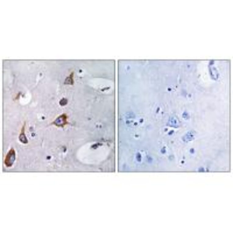 Immunohistochemistry - CHSY1 Antibody from Signalway Antibody (34588) - Antibodies.com