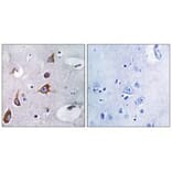 Immunohistochemistry - CHSY1 Antibody from Signalway Antibody (34588) - Antibodies.com