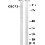 Western blot - CBCP2 Antibody from Signalway Antibody (34637) - Antibodies.com