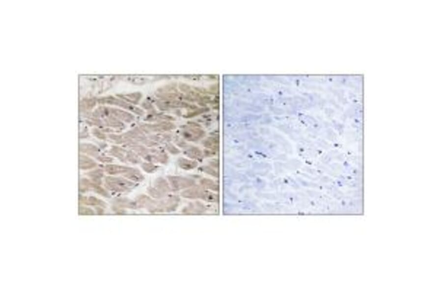 Immunohistochemistry - CBCP2 Antibody from Signalway Antibody (34637) - Antibodies.com