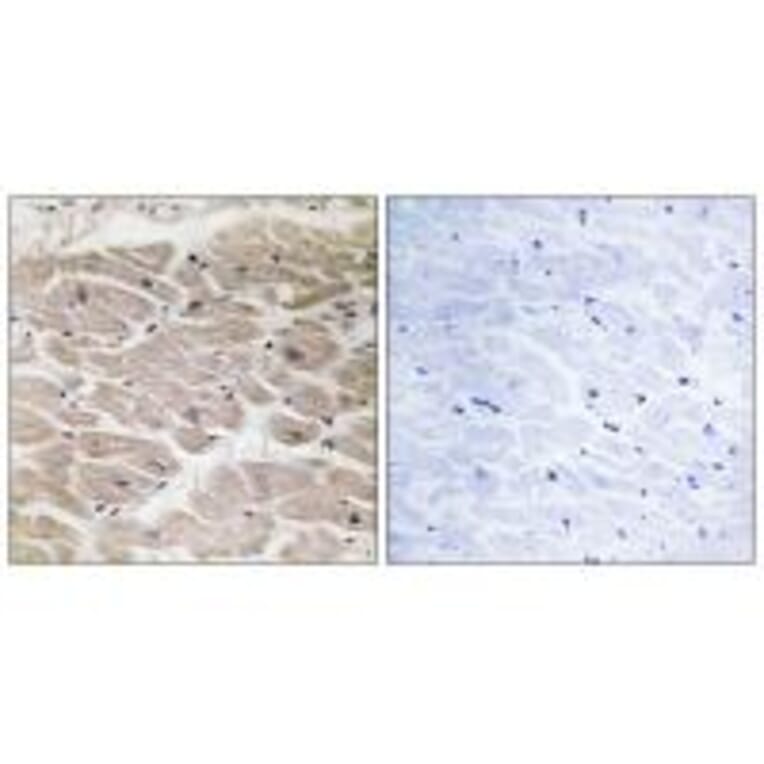 Immunohistochemistry - CBCP2 Antibody from Signalway Antibody (34637) - Antibodies.com