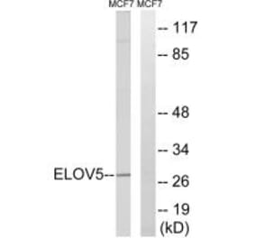 Western blot - ELOVL5 Antibody from Signalway Antibody (34673) - Antibodies.com