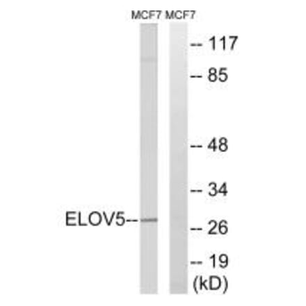 Western blot - ELOVL5 Antibody from Signalway Antibody (34673) - Antibodies.com