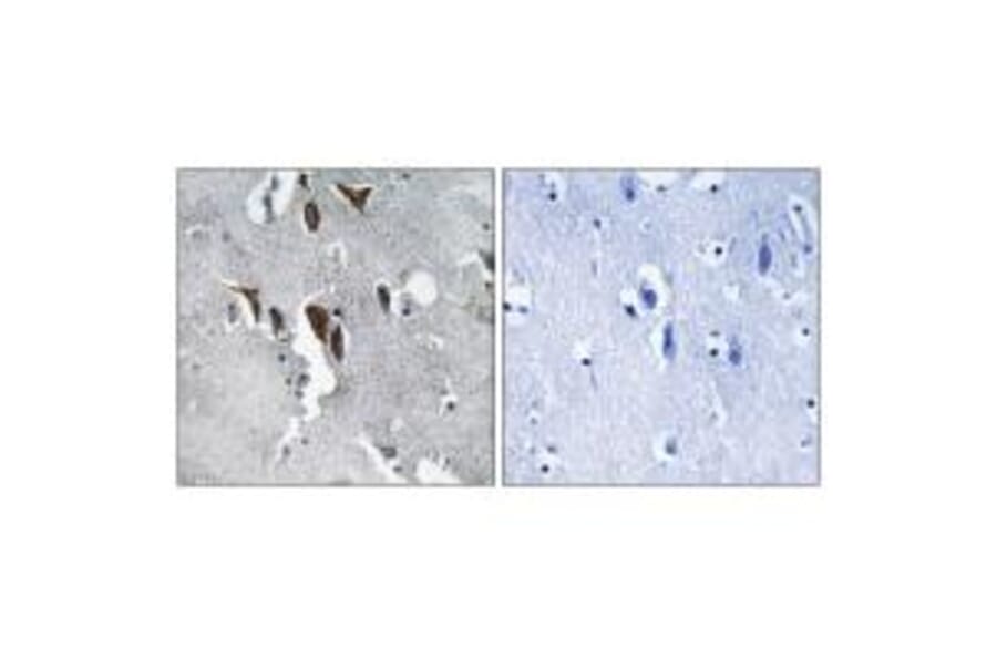 Immunohistochemistry - ELOVL5 Antibody from Signalway Antibody (34673) - Antibodies.com
