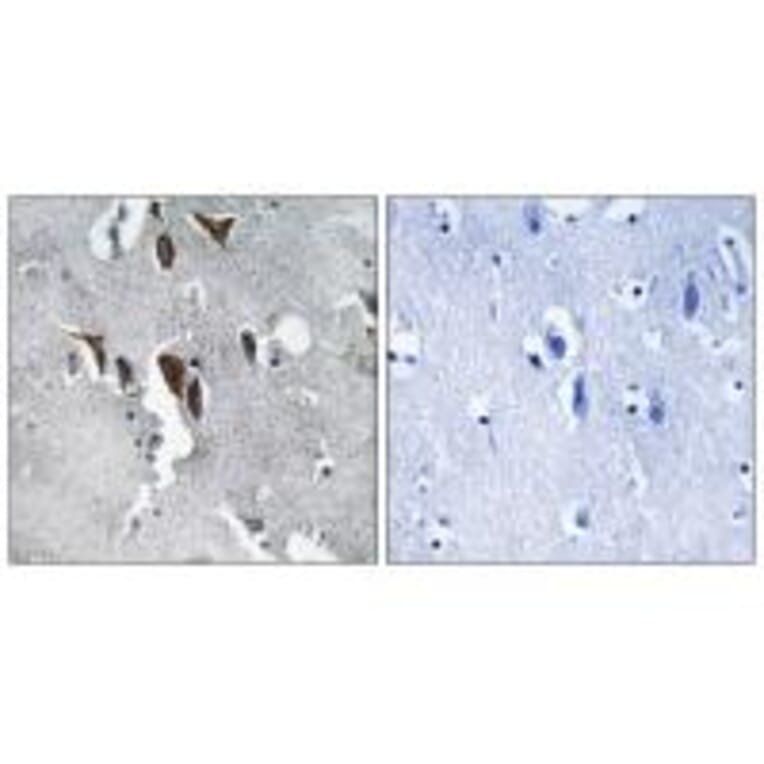 Immunohistochemistry - ELOVL5 Antibody from Signalway Antibody (34673) - Antibodies.com