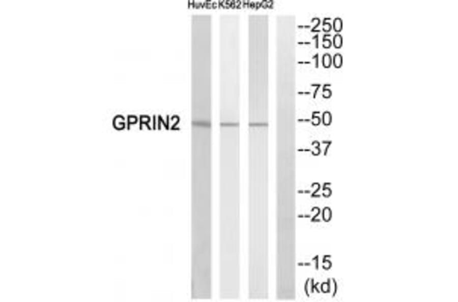 Western blot - GPRIN2 Antibody from Signalway Antibody (34692) - Antibodies.com