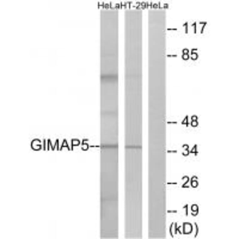 Western blot - GIMAP5 Antibody from Signalway Antibody (34719) - Antibodies.com