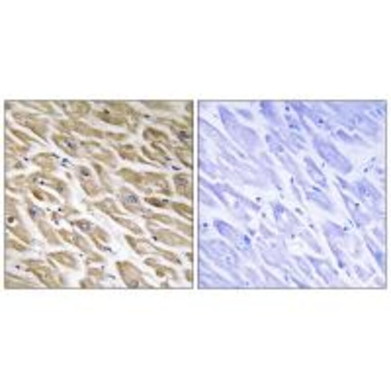 Immunohistochemistry - MRPL39 Antibody from Signalway Antibody (34802) - Antibodies.com