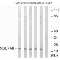 Western blot analysis of extracts from MCF-7 cells, 293 cells, HUVEC cells, HepG2 cells and Jurkat cells, using NDUFA8 antibody #34829.