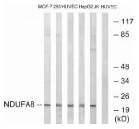 Western blot - NDUFA8 Antibody from Signalway Antibody (34829) - Antibodies.com