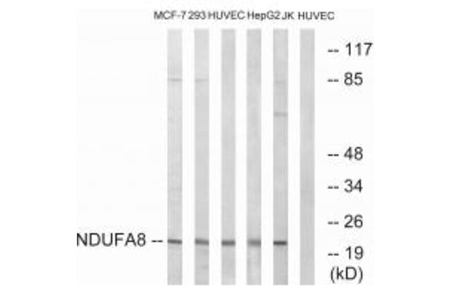 Western blot - NDUFA8 Antibody from Signalway Antibody (34829) - Antibodies.com