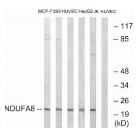 Western blot - NDUFA8 Antibody from Signalway Antibody (34829) - Antibodies.com