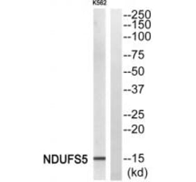 Western blot - NDUFS5 Antibody from Signalway Antibody (34835) - Antibodies.com