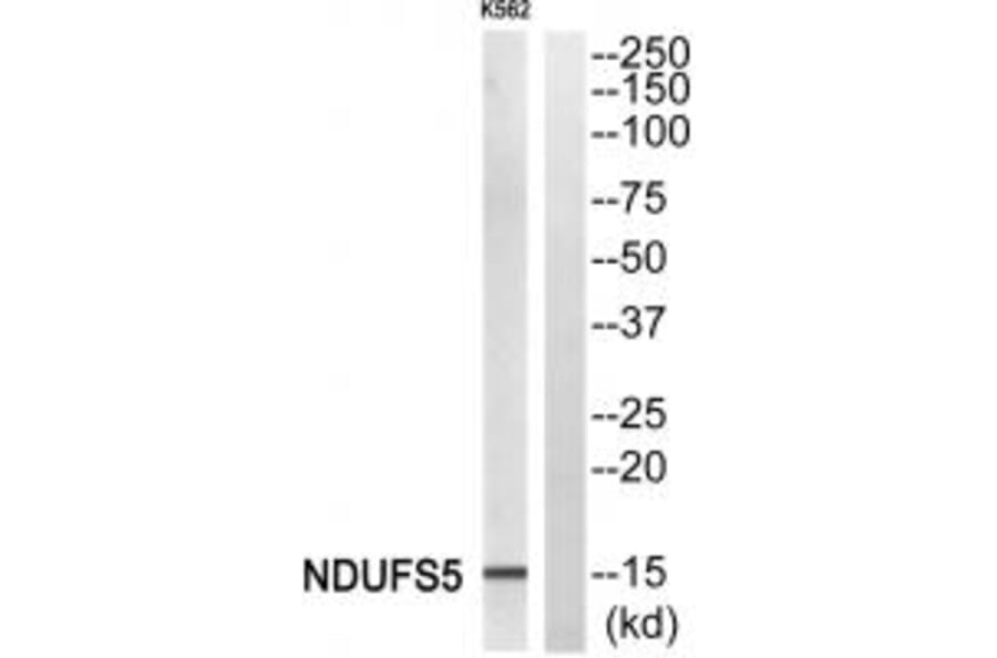 Western blot - NDUFS5 Antibody from Signalway Antibody (34835) - Antibodies.com