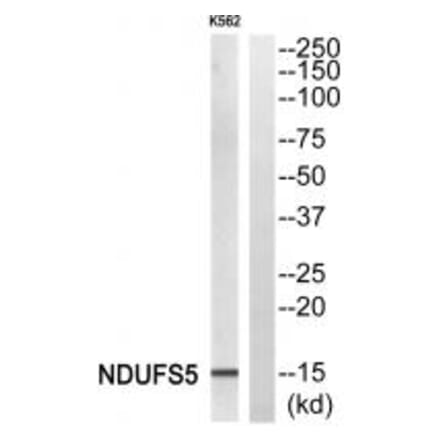 Western blot - NDUFS5 Antibody from Signalway Antibody (34835) - Antibodies.com