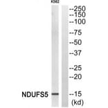 Western blot - NDUFS5 Antibody from Signalway Antibody (34835) - Antibodies.com