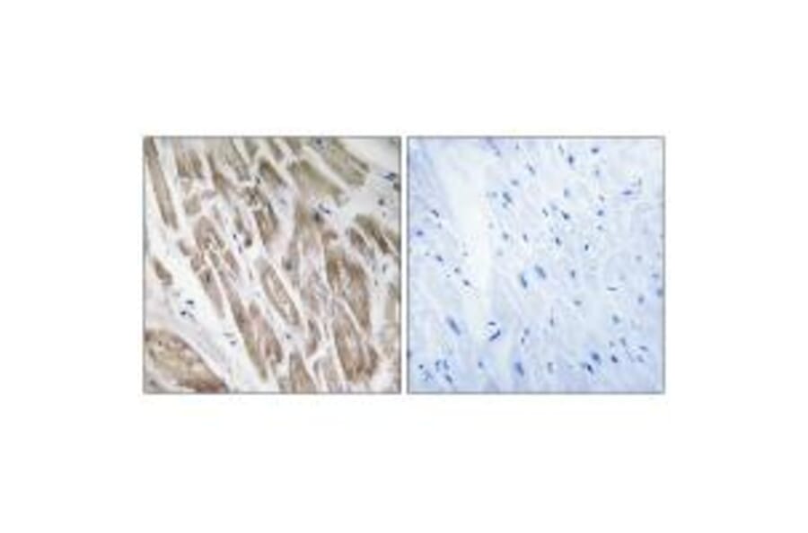 Immunohistochemistry - NDUFS5 Antibody from Signalway Antibody (34835) - Antibodies.com